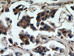Cathepsin B Rabbit anti-Human, Mouse, Polyclonal, Proteintech:Antibodies:Primary