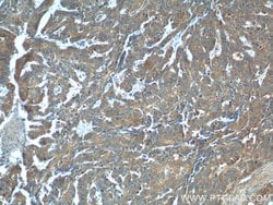 Cathepsin B Rabbit anti-Human, Mouse, Polyclonal, Proteintech:Antibodies:Primary