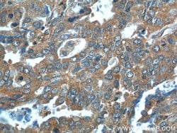 Cathepsin B Rabbit anti-Human, Mouse, Polyclonal, Proteintech:Antibodies:Primary