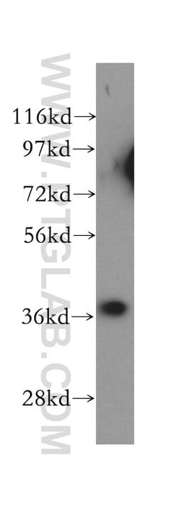 Cathepsin B Rabbit anti-Human, Mouse, Polyclonal, Proteintech:Antibodies:Primary