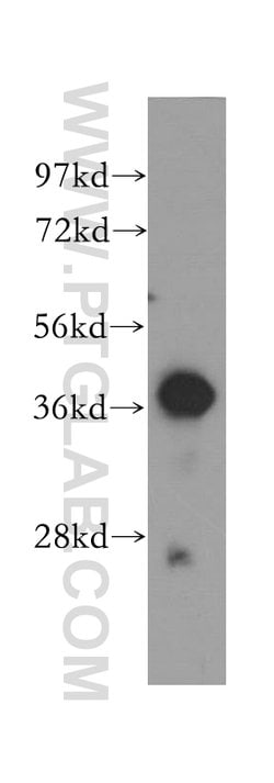Cathepsin B Rabbit anti-Human, Mouse, Polyclonal, Proteintech:Antibodies:Primary