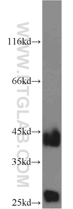 Cathepsin B Rabbit anti-Human, Mouse, Polyclonal, Proteintech:Antibodies:Primary