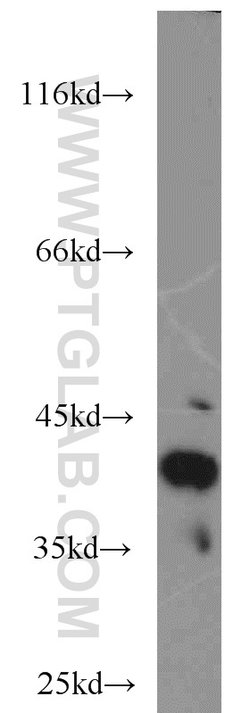Cathepsin B Rabbit anti-Human, Mouse, Polyclonal, Proteintech:Antibodies:Primary