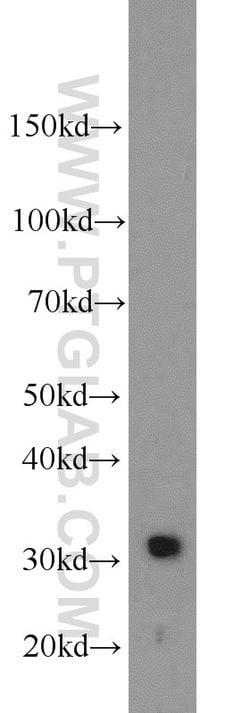 Cathepsin B Rabbit anti-Human, Mouse, Polyclonal, Proteintech:Antibodies:Primary