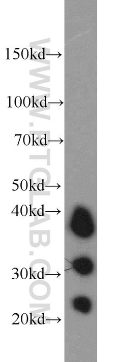 Cathepsin B Rabbit anti-Human, Mouse, Polyclonal, Proteintech:Antibodies:Primary