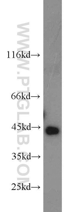 Cathepsin B Rabbit anti-Human, Mouse, Polyclonal, Proteintech:Antibodies:Primary