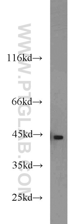 Cathepsin B Rabbit anti-Human, Mouse, Polyclonal, Proteintech:Antibodies:Primary
