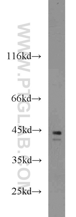 Cathepsin B Rabbit anti-Human, Mouse, Polyclonal, Proteintech:Antibodies:Primary