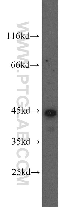 Cathepsin B Rabbit anti-Human, Mouse, Polyclonal, Proteintech:Antibodies:Primary