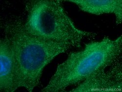 RAB38 Rabbit anti-Human, Mouse, Polyclonal, Proteintech 150 &mu;L; Unconjugated:Antibodies,