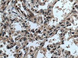 RAB38 Rabbit anti-Human, Mouse, Polyclonal, Proteintech 150 &mu;L; Unconjugated:Antibodies,