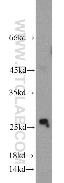 RAB38 Rabbit anti-Human, Mouse, Polyclonal, Proteintech 150 &mu;L; Unconjugated:Antibodies,