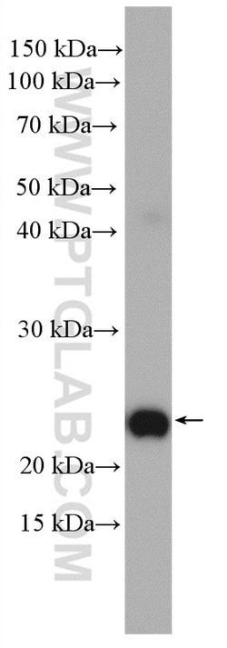 RAB38 Rabbit anti-Human, Mouse, Polyclonal, Proteintech 150 &mu;L; Unconjugated:Antibodies,