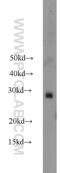RAB38 Rabbit anti-Human, Mouse, Polyclonal, Proteintech 150 &mu;L; Unconjugated:Antibodies,