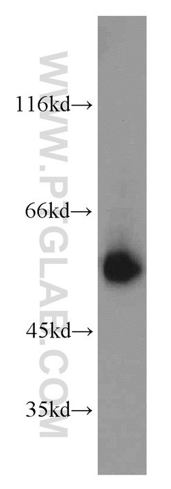 LCAT Rabbit anti-Human, Mouse, Rat, Polyclonal, Proteintech:Antibodies:Primary