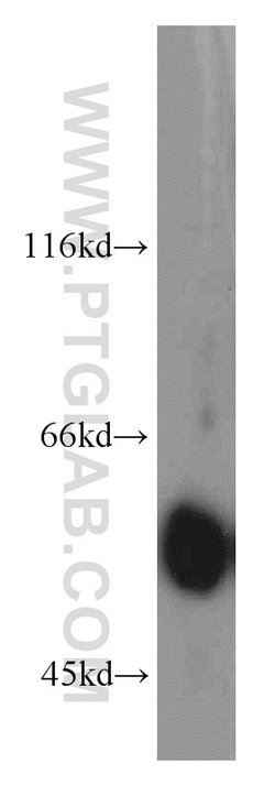 LCAT Rabbit anti-Human, Mouse, Rat, Polyclonal, Proteintech:Antibodies:Primary