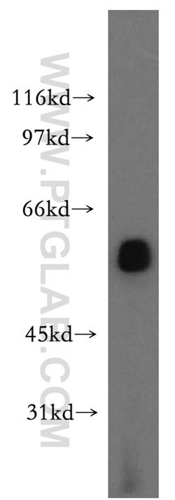 LCAT Rabbit anti-Human, Mouse, Rat, Polyclonal, Proteintech:Antibodies:Primary