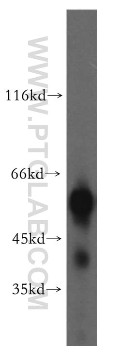 LCAT Rabbit anti-Human, Mouse, Rat, Polyclonal, Proteintech:Antibodies:Primary