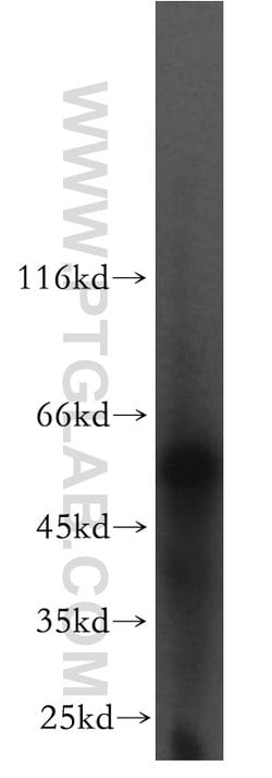 LCAT Rabbit anti-Human, Mouse, Rat, Polyclonal, Proteintech:Antibodies:Primary