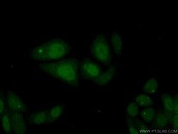 MCM10 Rabbit anti-Human, Mouse, Polyclonal, Proteintech 150 &mu;L; Unconjugated:Antibodies,