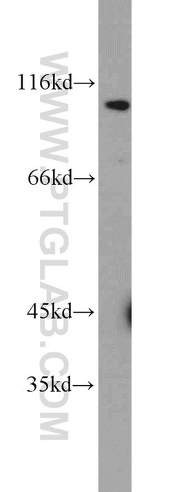MCM10 Rabbit anti-Human, Mouse, Polyclonal, Proteintech 150 &mu;L; Unconjugated:Antibodies,