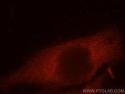 CCT8 Rabbit anti-Human, Mouse, Rat, Zebrafish, Polyclonal, Proteintech