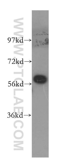 CCT8 Rabbit anti-Human, Mouse, Rat, Zebrafish, Polyclonal, Proteintech