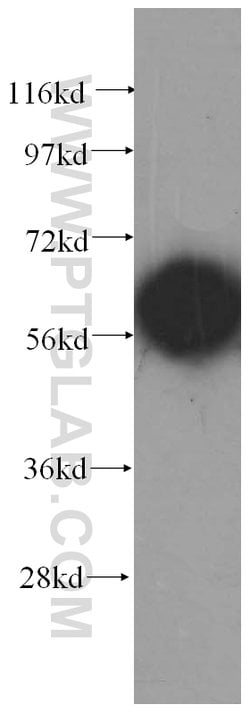 CCT8 Rabbit anti-Human, Mouse, Rat, Zebrafish, Polyclonal, Proteintech