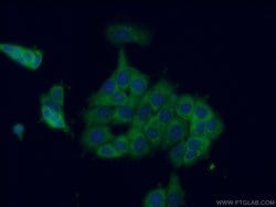 CCT8 Rabbit anti-Human, Mouse, Rat, Zebrafish, Polyclonal, Proteintech