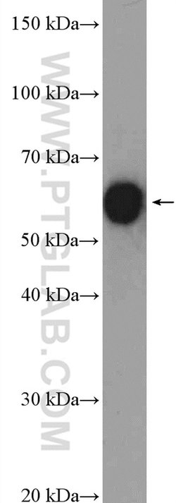 CCT8 Rabbit anti-Human, Mouse, Rat, Zebrafish, Polyclonal, Proteintech