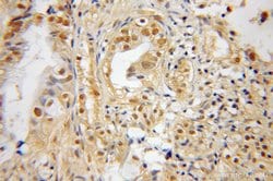 SNX7 Rabbit anti-Human, Mouse, Rat, Polyclonal, Proteintech:Antibodies:Primary