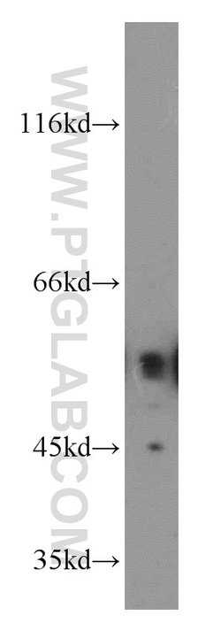 ETS2 Rabbit anti-Human, Mouse, Polyclonal, Proteintech 20 &mu;L; Unconjugated:Antibodies,