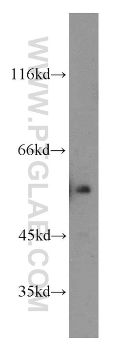 ETS2 Rabbit anti-Human, Mouse, Polyclonal, Proteintech 20 &mu;L; Unconjugated:Antibodies,
