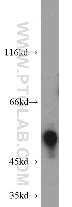 ETS2 Rabbit anti-Human, Mouse, Polyclonal, Proteintech 20 &mu;L; Unconjugated:Antibodies,