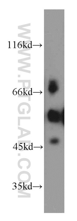 ETS2 Rabbit anti-Human, Mouse, Polyclonal, Proteintech 20 &mu;L; Unconjugated:Antibodies,