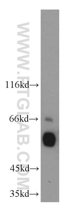 ETS2 Rabbit anti-Human, Mouse, Polyclonal, Proteintech 20 &mu;L; Unconjugated:Antibodies,