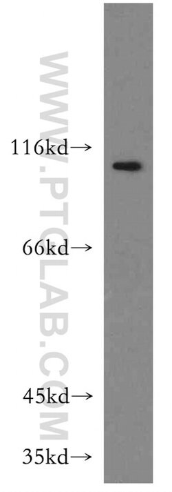 LEO1 Rabbit anti-Human, Mouse, Rat, Polyclonal, Proteintech 150 &mu;L;