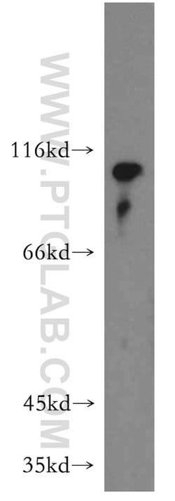 LEO1 Rabbit anti-Human, Mouse, Rat, Polyclonal, Proteintech 150 &mu;L;