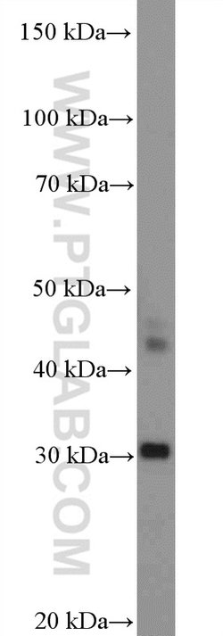 CIDEC Rabbit anti-Human, Polyclonal, Proteintech:Anticuerpos:Anticuerpos
