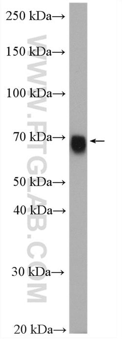 GATAD2A Rabbit anti-Human, Mouse, Rat, Polyclonal, Proteintech