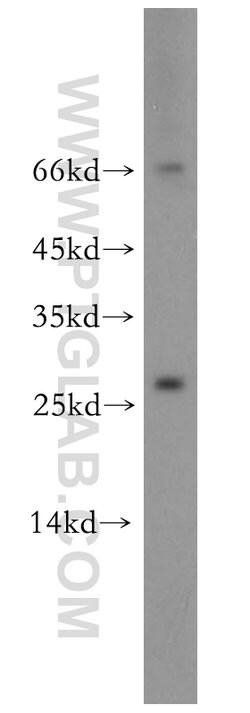 Neurotrophin 4 Rabbit anti-Human, Mouse, Rat, Polyclonal, Proteintech:Antibodies:Primary