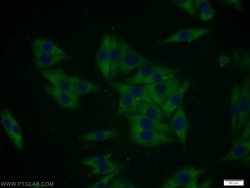 MTMR8 Rabbit anti-Human, Polyclonal, Proteintech:Antibodies:Primary Antibodies