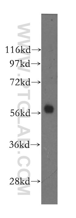 MTMR8 Rabbit anti-Human, Polyclonal, Proteintech:Antibodies:Primary Antibodies