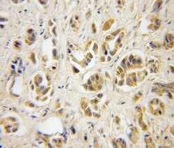 TBCA Rabbit anti-Human, Mouse, Rat, Polyclonal, Proteintech:Anticuerpos:Anticuerpos