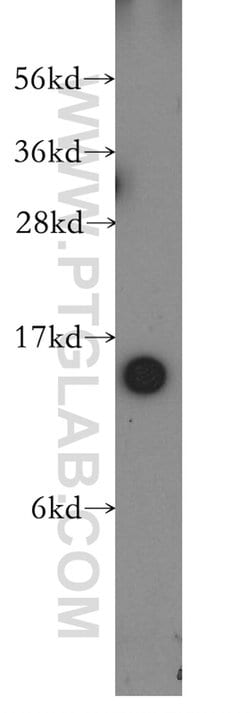 TBCA Rabbit anti-Human, Mouse, Rat, Polyclonal, Proteintech:Anticuerpos:Anticuerpos