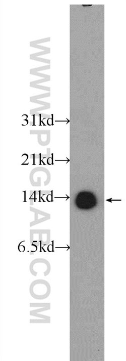 TBCA Rabbit anti-Human, Mouse, Rat, Polyclonal, Proteintech