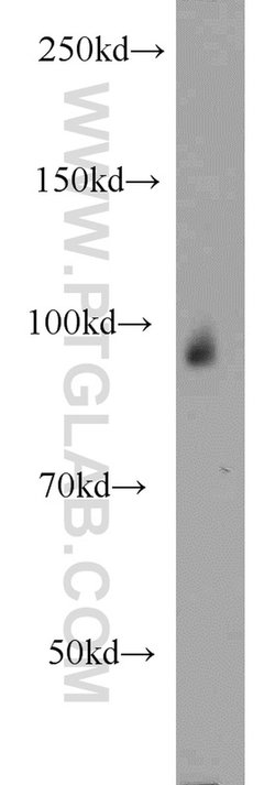 CHD2 Rabbit anti-Human, Rat, Polyclonal, Proteintech 20 &mu;L; Unconjugated:Antibodies,