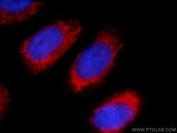 ACAA1 Rabbit anti-Human, Mouse, Rat, Polyclonal, Proteintech 150 &mu;L;