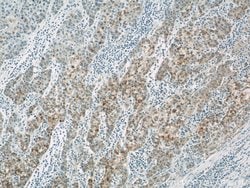 ACAA1 Rabbit anti-Human, Mouse, Rat, Polyclonal, Proteintech 150 &mu;L;
