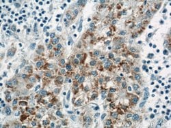 ACAA1 Rabbit anti-Human, Mouse, Rat, Polyclonal, Proteintech 150 &mu;L;